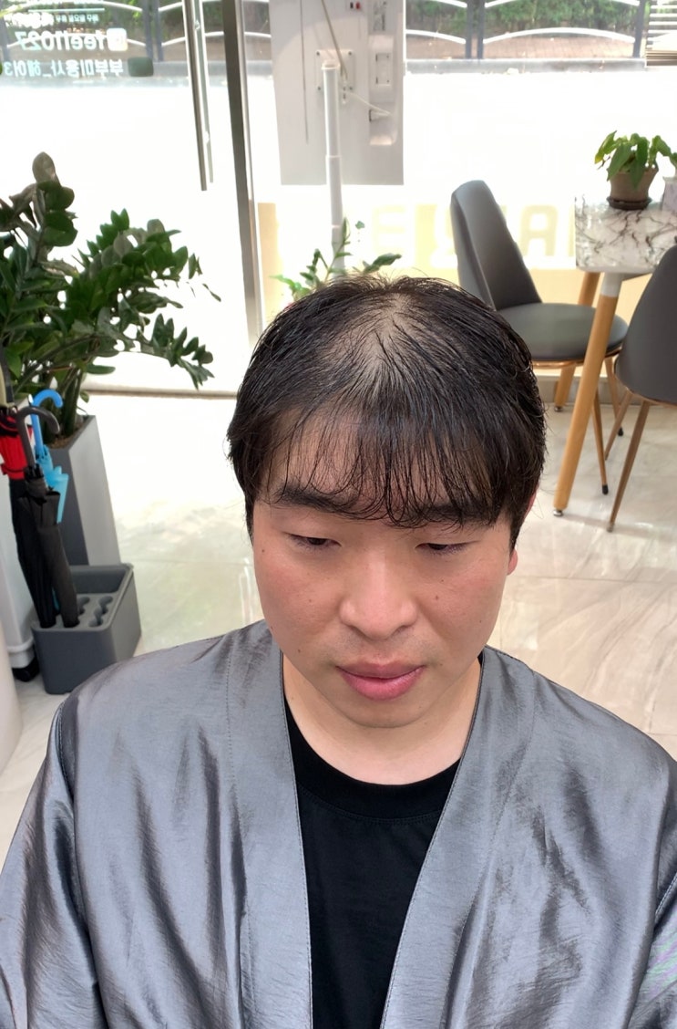 대구 남자 정수리 탈모펌 전문 미용실