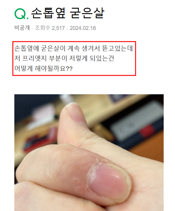  청주 손톱 굳은살, 이것만 알아도 90%가 좋아집니다.