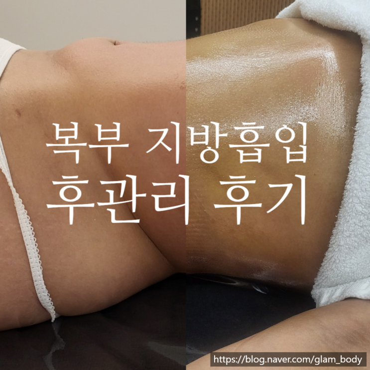  복부 지방흡입 후관리 피부톤과 바본 개선 후기