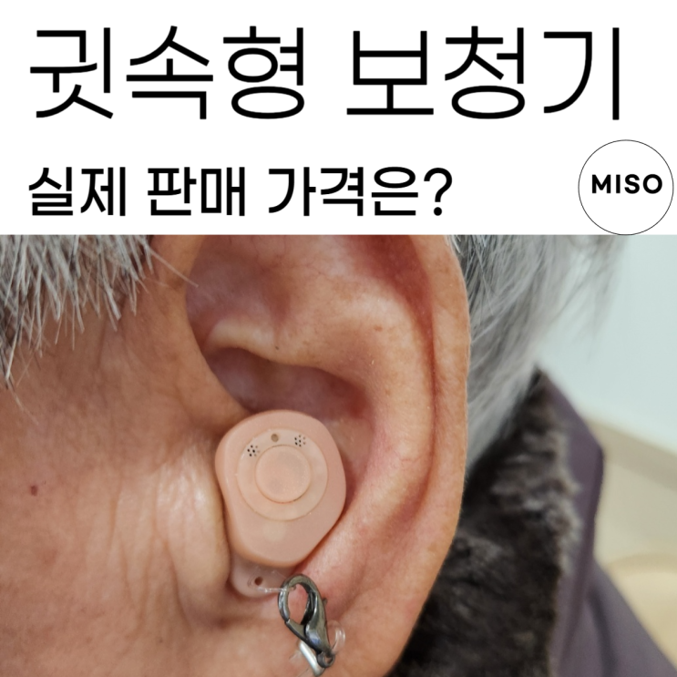  귓속형보청기 가격 실제 판매가는 얼마나 할까
