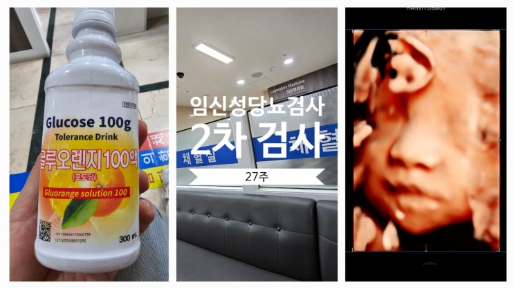  27주 둘째 이야기 임신성 당뇨(임당) 재검사