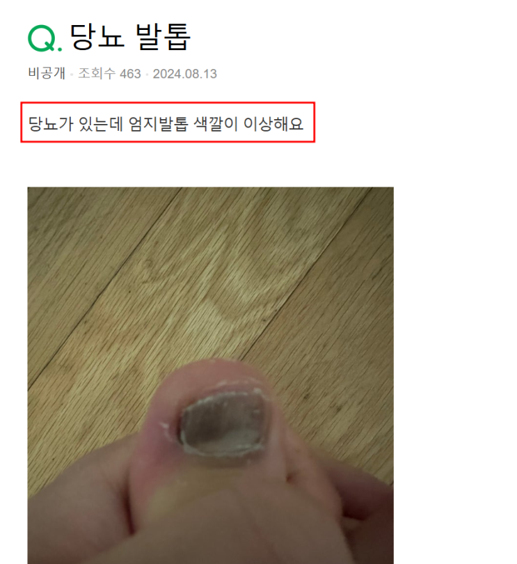  청주 당뇨발톱, 걱정을 절반으로 줄여드립니다.