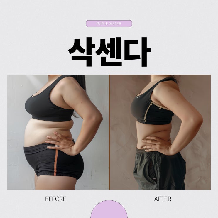  은평구내과 삭센다 술 먹어도 되나요? 다이어트 제대로 하기