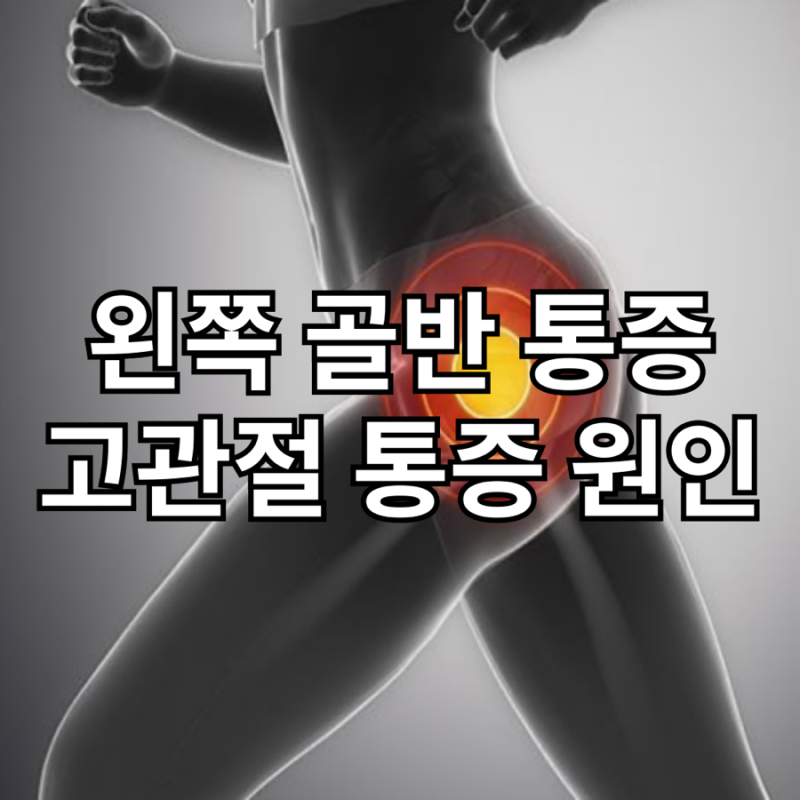 여자 왼쪽 골반 통증과 고관절 통증 원인 및 해결법