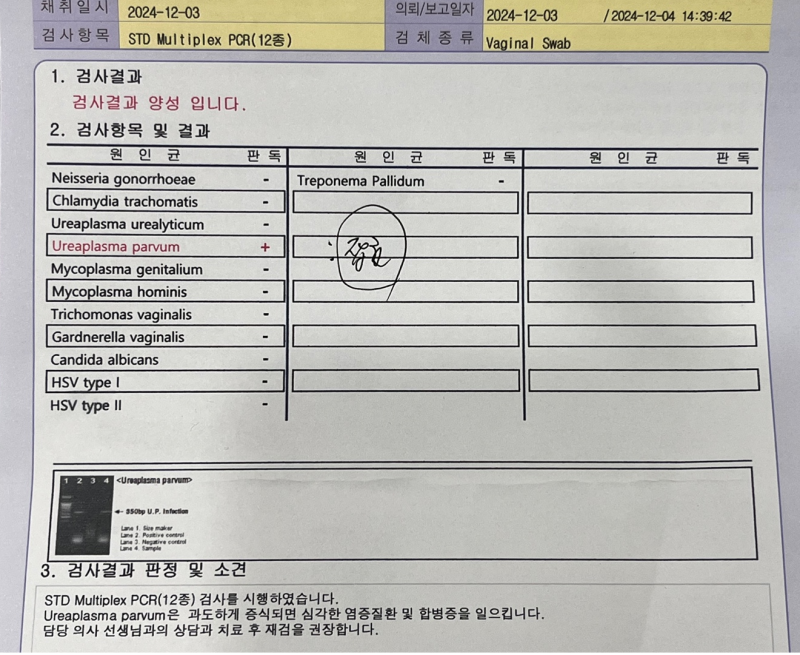 질염(STD검사)종류 및 검진결과, 비용 기록하기.