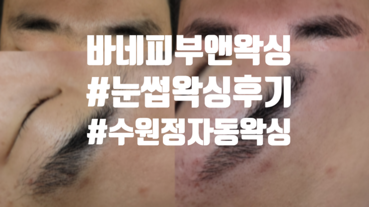  수원 정자동 왁싱 바네피부앤왁싱 눈썹왁싱 후기