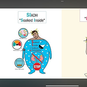 SIADH vs 의학용어 DI(Diabetes Insipidus) 요붕증 비교 공부하기
