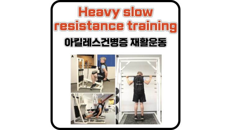  아킬레스건병증 재활 운동 고강도 느린 저항 운동(Heavy slow resistance training)