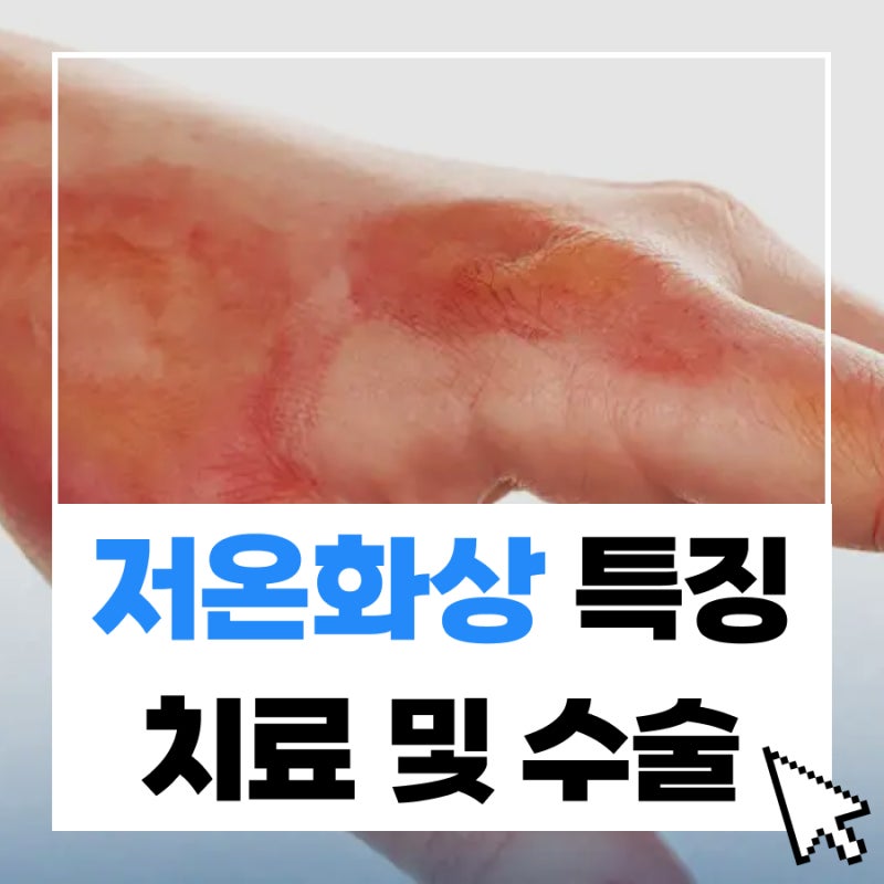 저온화상피부과 온도 치료 수술 및 특징은?