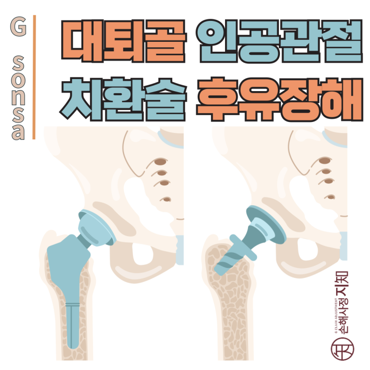  대퇴골 골절 후유장해, 보험사와 분쟁 이렇게 해결했어요 - [엄마의 질병, 2부]