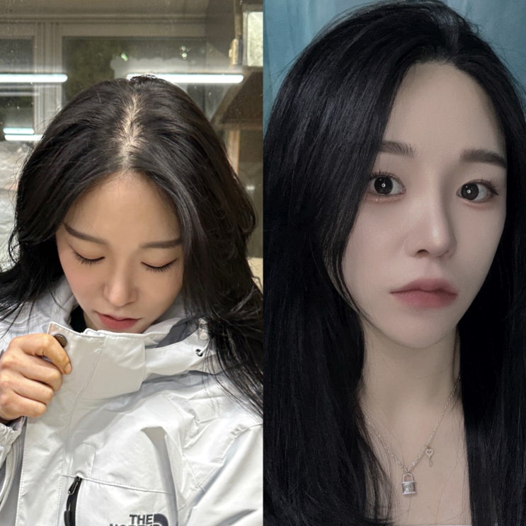  정수리 탈모 3개월 그로우턴 사용 후 변화 후기