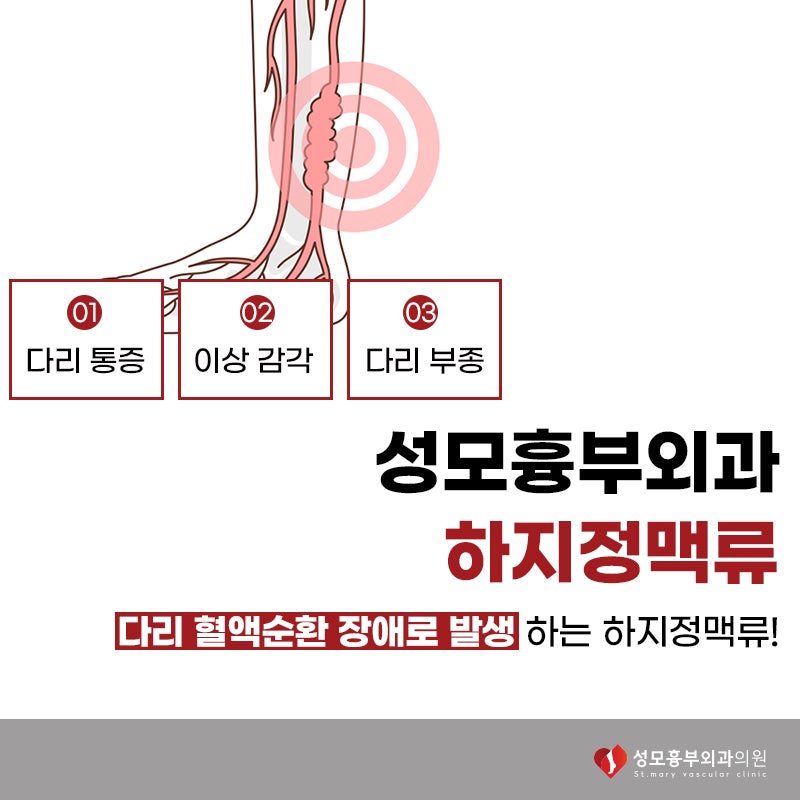 청주하지정맥류는 무엇일까? 원인과, 증상, 치료법