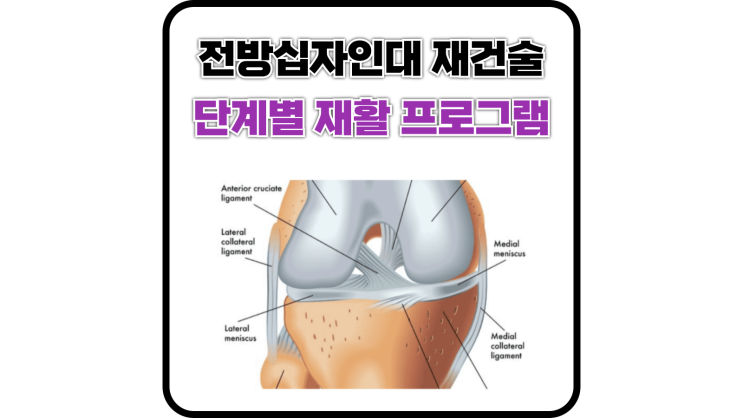  전방십자인대 재건술 단계별 재활 프로그램
