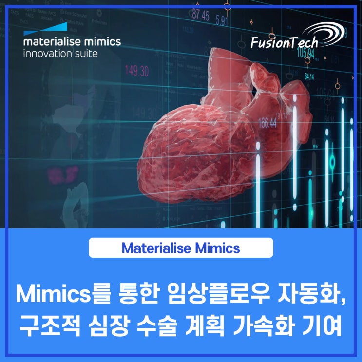  [Materialise S/W] FEops가 Mimics를 통해 구조적 심장 수술 계획을 가속화한 방법