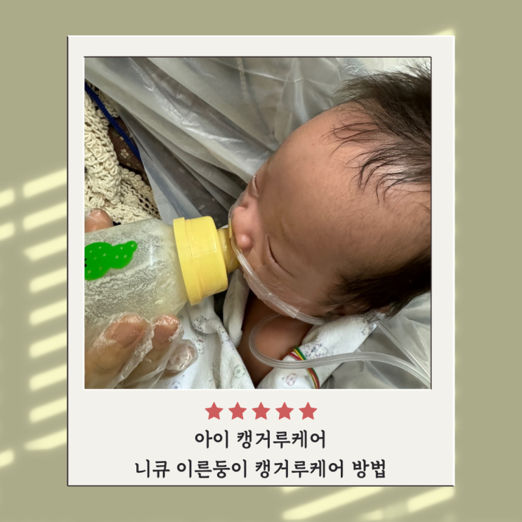 아이 캥거루케어 니큐 이른둥이 캥거루케어 방법 아이 캥거루케어 니큐 이른둥이 캥거루케어 방법