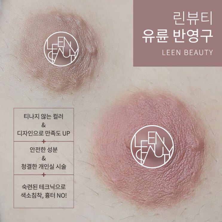  강남 유륜미백 시술 잘하는곳 추천 및 정보