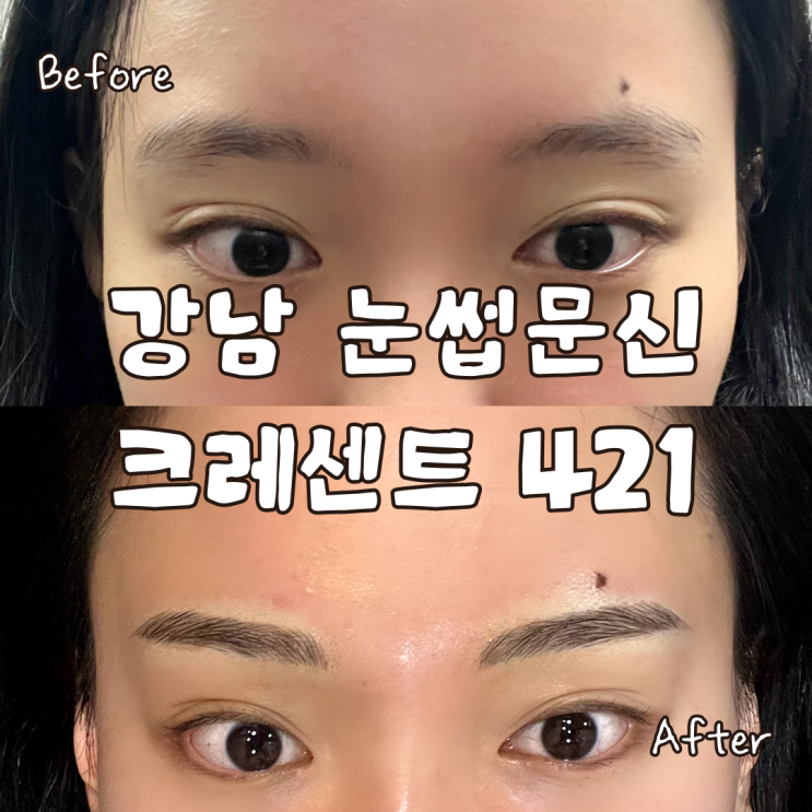  강남 반영구 눈썹 문신 잘하는 곳 크레센트 421 4D 엠보 후기