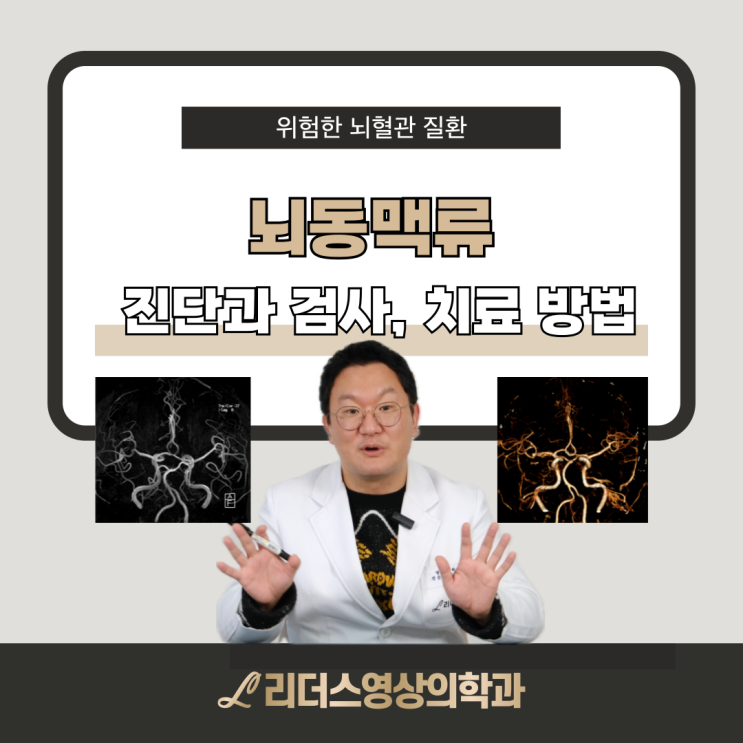  뇌동맥류 진단과 검사, 치료방법, 궁금한점