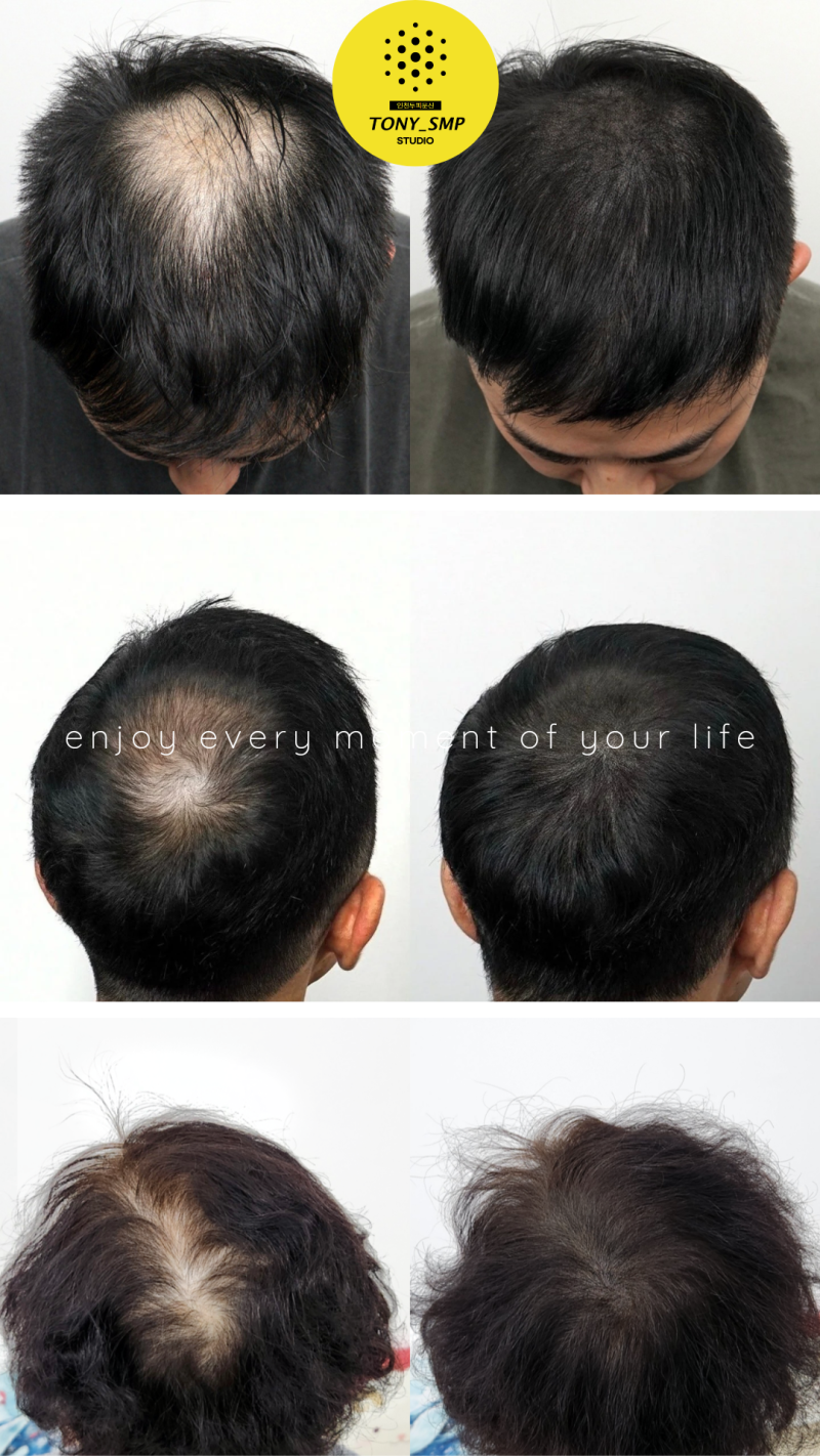 안산왁싱왁스캣/안산브라질리언/속눈썹 (@waxcatansan) • Instagram photos and videos, image size:800x1422