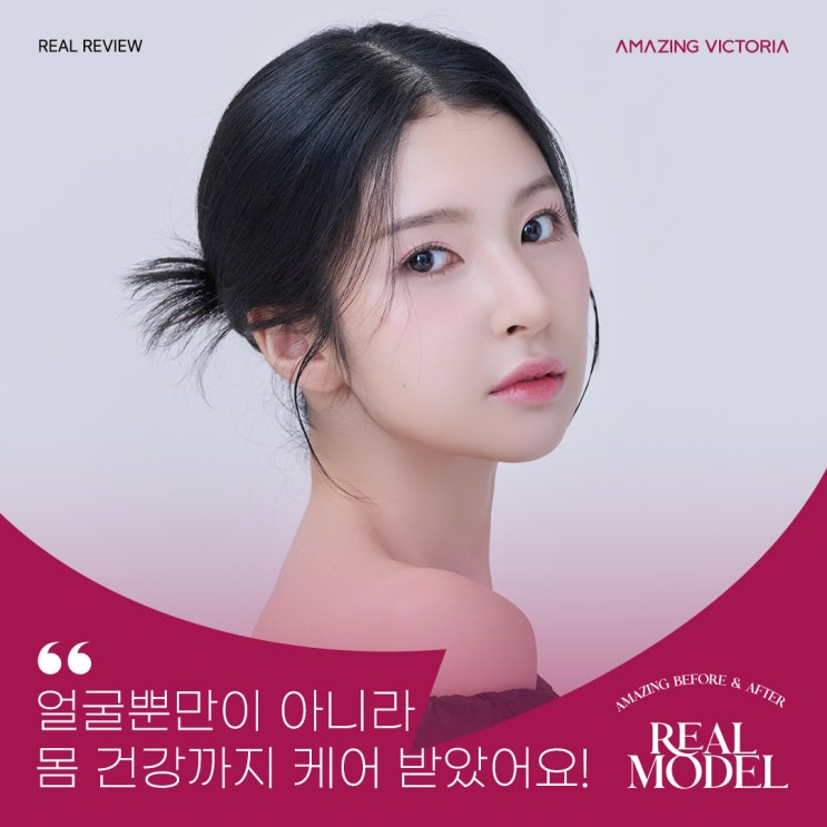  왼쪽 얼굴에 자신이 없던 20대 후반 리얼모델의 어메이징 인터뷰
