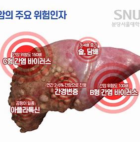 급성 바이러스 간염 개요