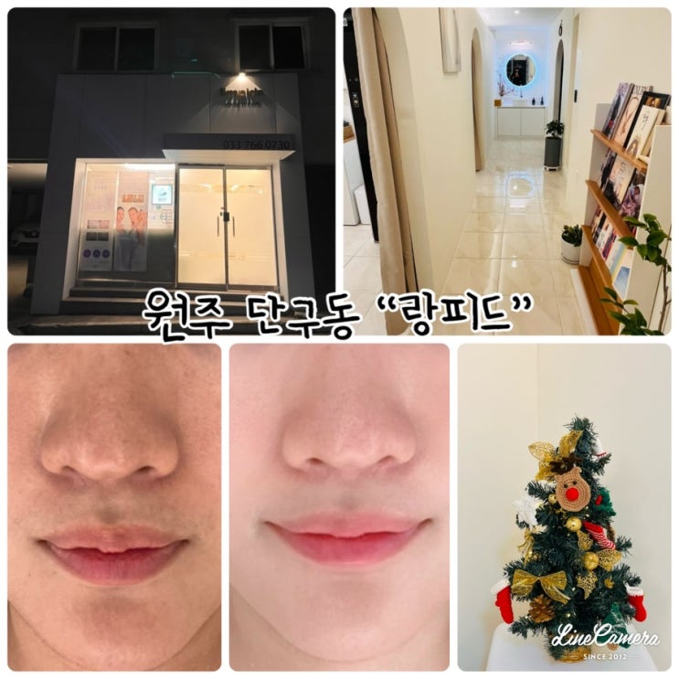  원주피부관리 "랑피드" 1;1맞춤케어로 속건조가심해 방문한 단구동에스테틱