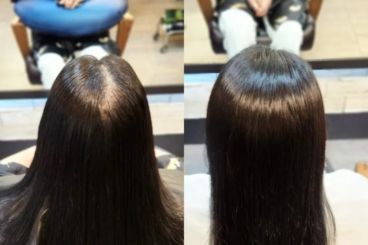  수원미용실 아엠헤드헤어: 여자 갈라지는 가르마 모류교정펌으로 볼륨 업!