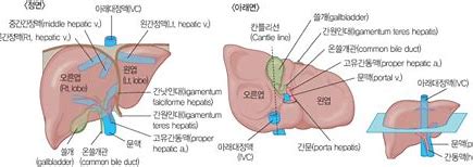 간 종양의종류1 -간 혈관종