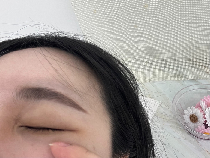  나이들어 보이게 만드는 눈가 눈밑주름 없애는법 고민 해결!