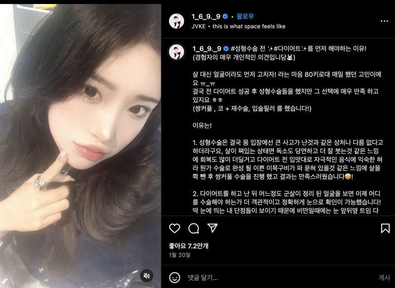 최준희 DM으로 성형수술 정보 공개