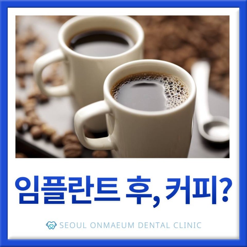 임플란트 식립후 커피, 마셔도 될까요?