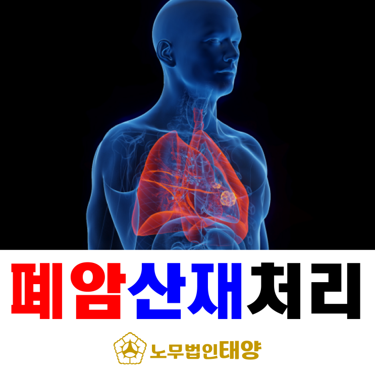  폐암 산재 처리 방법 - 산업재해 신청부터 보상까지