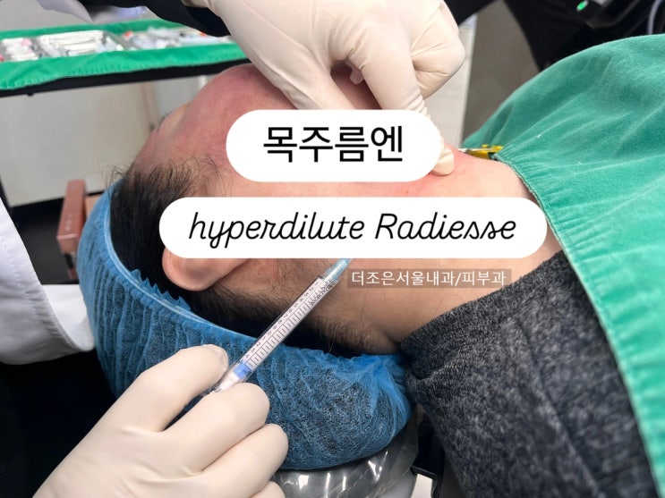  가로목주름 시술 필러 보톡스 콜라겐부스터 서브시전 리프팅