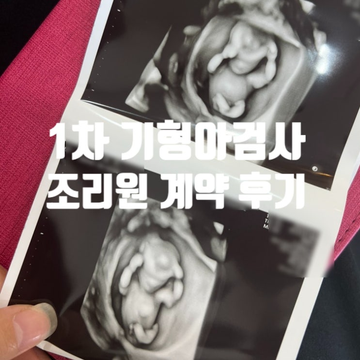 임신 :: 태아 성별 1차 기형아검사 목투명대 조리원계약 가격 임신 :: 태아 성별 1차 기형아검사 목투명대 조리원계약 가격