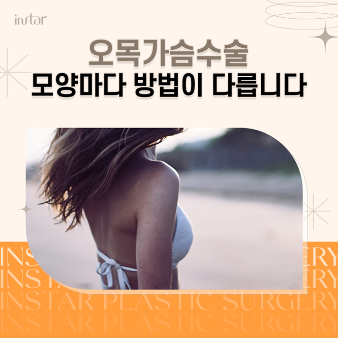  오목가슴수술 모양마다 방법이 다릅니다