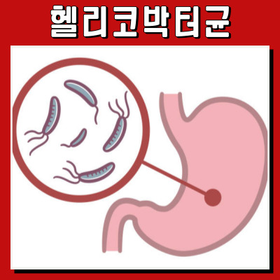  헬리코박터균이란? 원인부터 증상까지 한눈에!