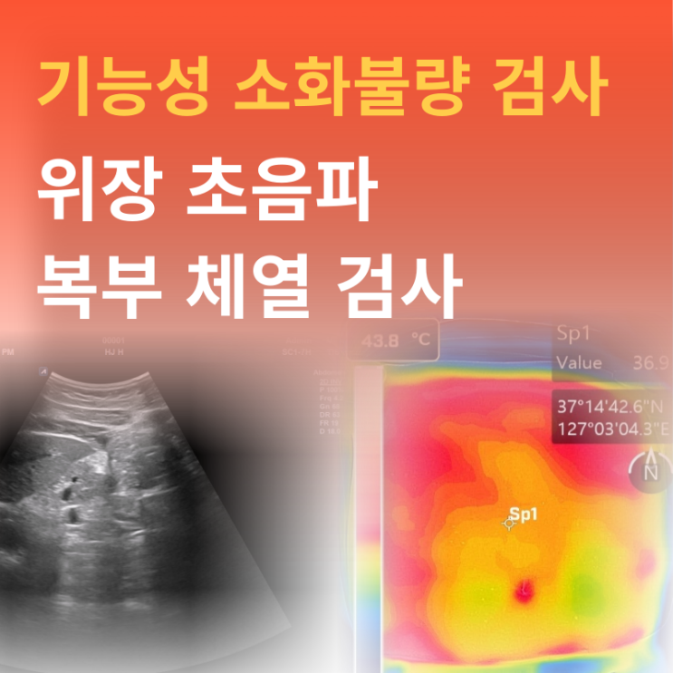  기능성 소화불량 해결을 위한 수원 망포 한의원의 위장 검사 방법