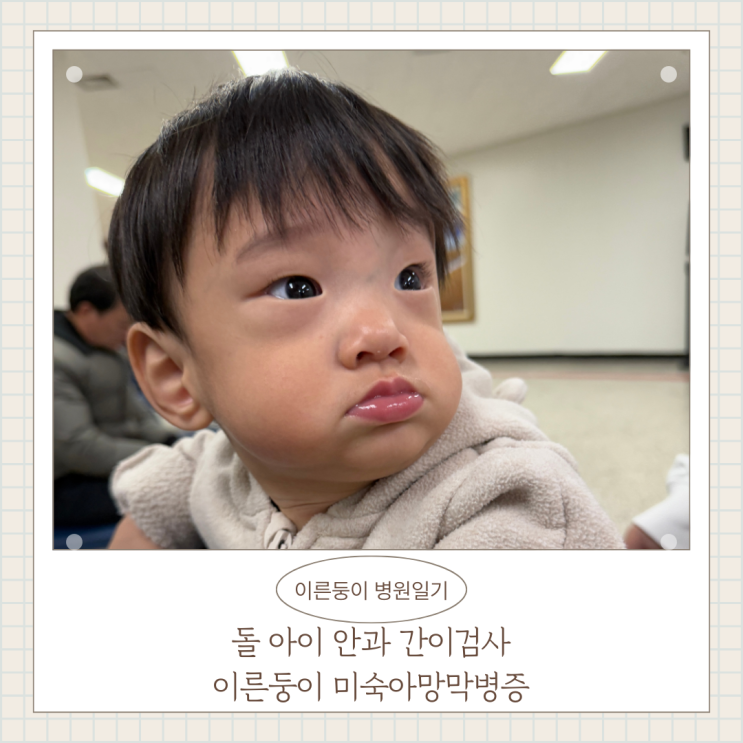 돌 아이 안과 간이검사 정기검진 미숙아망막병증 이른둥이 병원 주기 돌 아이 안과 간이검사 정기검진 미숙아망막병증 이른둥이 병원 주기