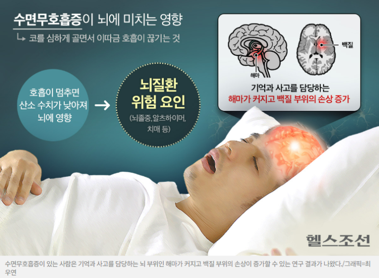 자면서 “컥” 수면무호흡, 뇌에 미치는 충격! 치매를 막으려면 반드시 이 치료가 필요해요! 자면서 “컥” 수면무호흡, 뇌에 미치는 충격! 치매를 막으려면 반드시 이 치료가 필요해요!