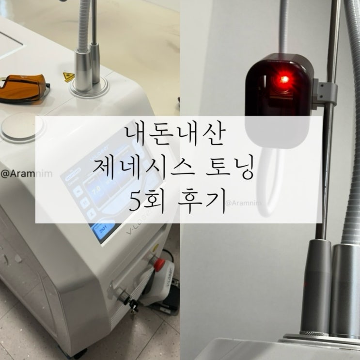 내돈내산 | 5회받아본 제네시스 레이저 솔직 후기 토닝 주기 가격 효과