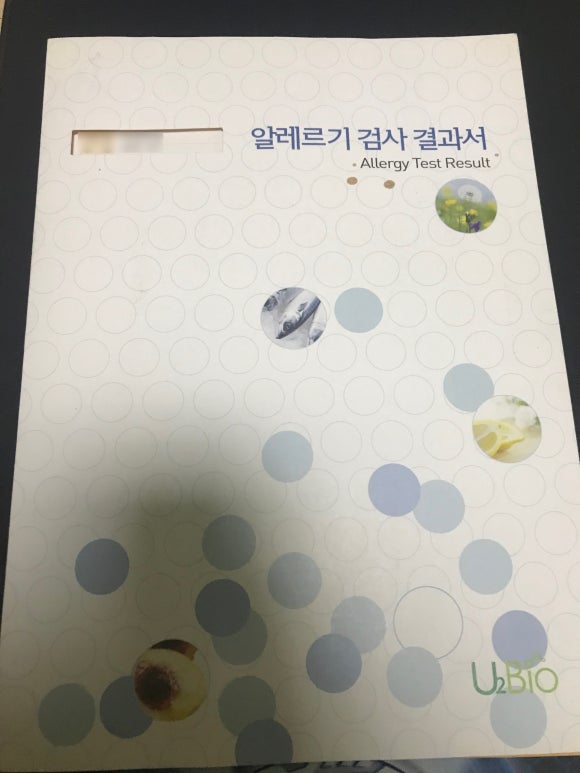  알레르기 검사 결과서 비용 결과