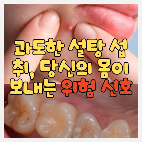  과도한 설탕 섭취, 당신의 몸이 보내는 위험 신호 7가지! - 피부 트러블(여드름)도 이것 때문!!