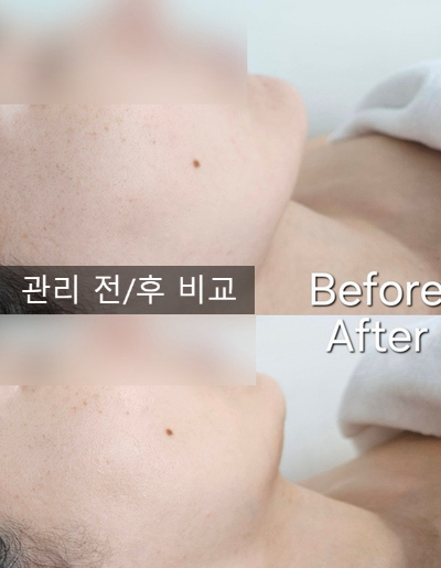  대구 월성동 피부관리 휴먼뷰티에스테틱