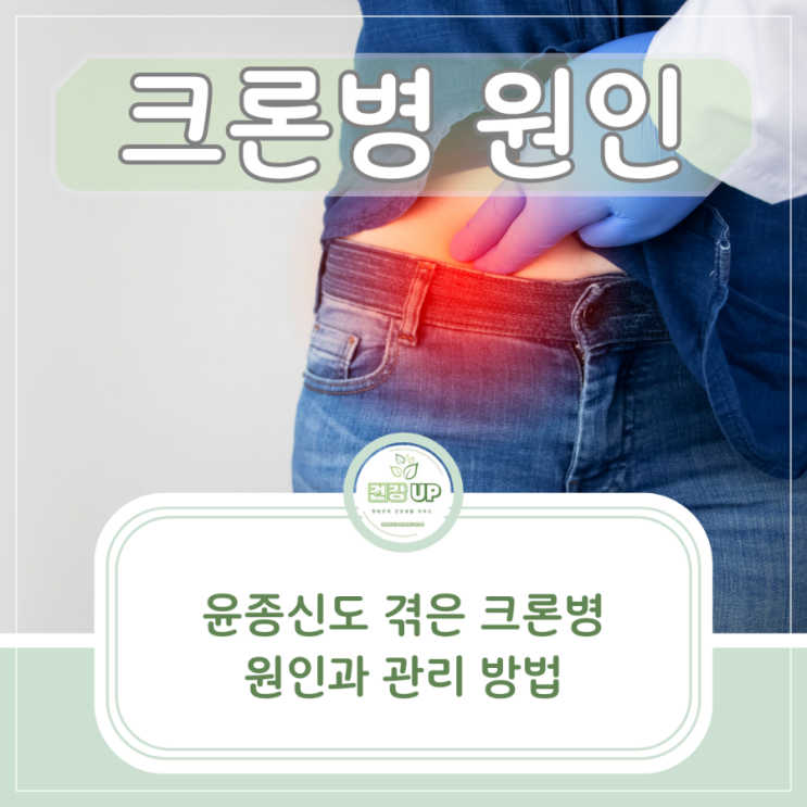 <b>윤종신 크론병</b> 원인 유전과 환경이 만드는 만성 염증성 질환