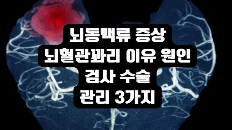  뇌동맥류증상 뇌혈관꽈리 이유 원인 검사 수술 관리3