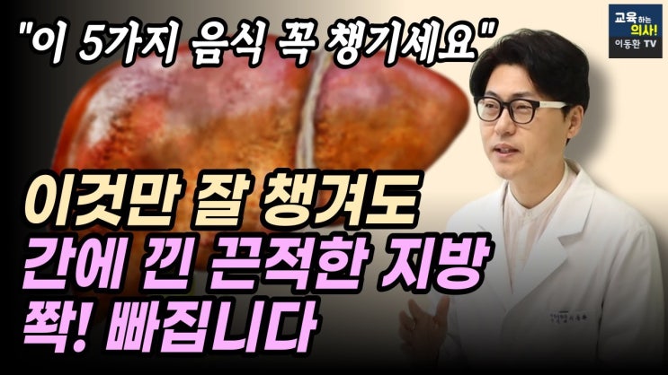 미국 간기능 전문 사이트가 발표한 간을 살리는 음식 5가지. 지방간, 간경화, 간암 등 간건강 지키는 음식. 미국 간기능 전문 사이트가 발표한 간을 살리는 음식 5가지. 지방간, 간경화, 간암 등 간건강 지키는 음식.