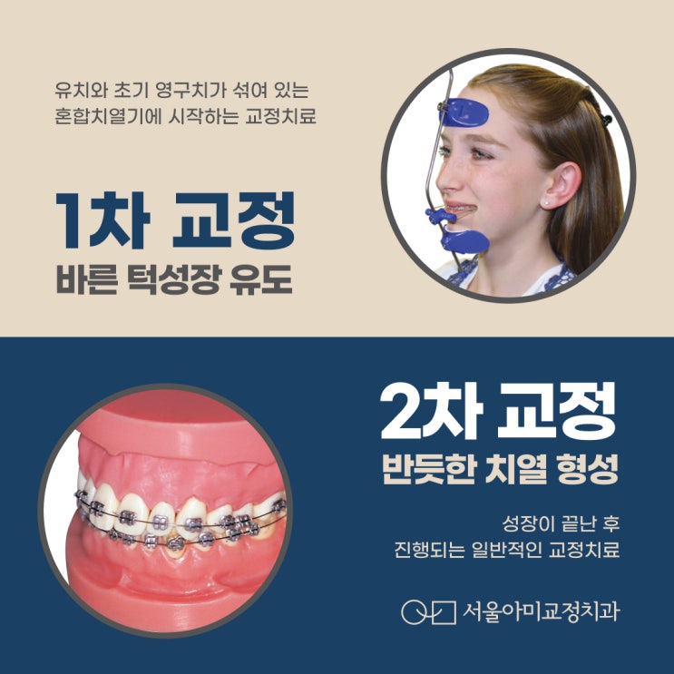  청라교정치과 1차 교정과 2차 교정에 대해