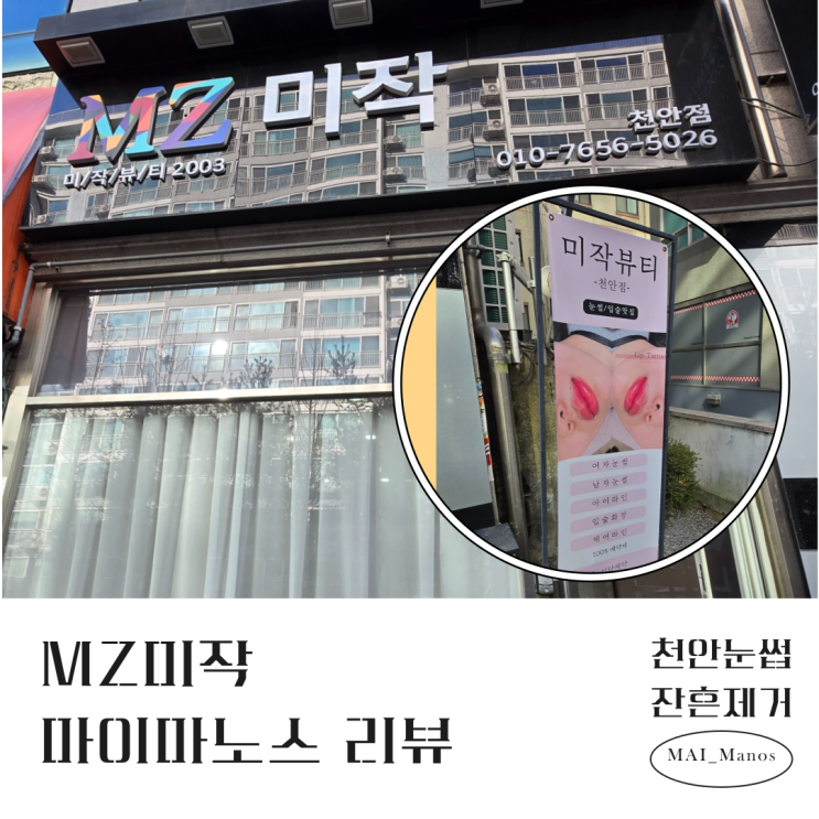  천안잔흔제거 실력좋은 곳 미작뷰티 천안점 리뷰