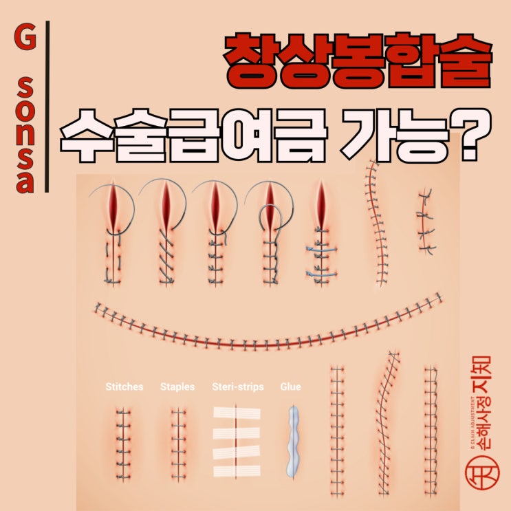  창상봉합술 했다고 다 수술보험금이 되는 건 아닙니다! -[보도자료, BoDa]