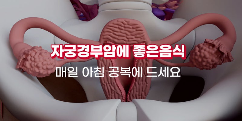 자궁경부암에 좋은 음식 도움이 얻으려면?